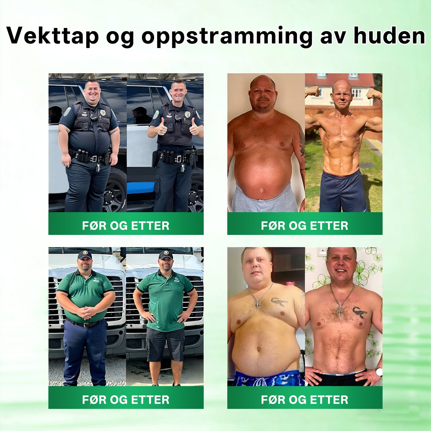 RUDAUO® Oppgradert stor-deknings 10-i-1 nano mikronålplaster (Synlige resultater på 7 dager)