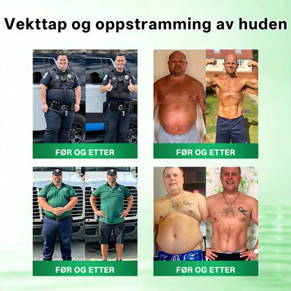 RUDAUO® Oppgradert stor-deknings 10-i-1 nano mikronålplaster (Synlige resultater på 7 dager)