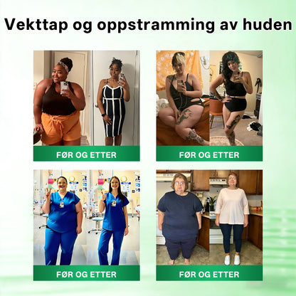 RUDAUO® Oppgradert stor-deknings 10-i-1 nano mikronålplaster (Synlige resultater på 7 dager)
